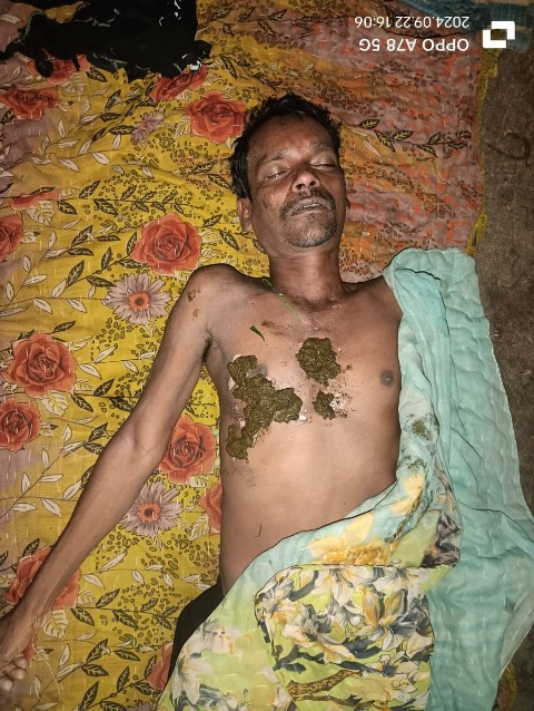 BREKIN NEWS आकाशीय बिजली गिरने से खम्हार गांव का एक व्यक्ति घायल। 1 1001547574